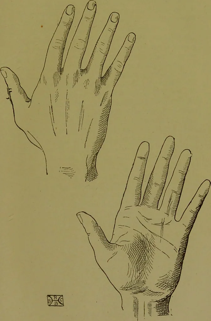 An illustration from A manual of cheirosophy : being a complete practical handbook of the twin sciences of cheirognomy and cheiromancy, by means whereof the past, the present, and the future may be read in the formations of the hands ; preceded by an introductory argument upon the science of cheirosophy and its claims to rank as a physical science / by Ed. Heron-Allen ... with full-page and other illustrations by Rosamund Brunel Horsley., 1892, leaf 157