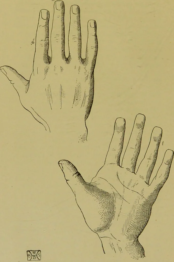 An illustration from A manual of cheirosophy : being a complete practical handbook of the twin sciences of cheirognomy and cheiromancy, by means whereof the past, the present, and the future may be read in the formations of the hands ; preceded by an introductory argument upon the science of cheirosophy and its claims to rank as a physical science / by Ed. Heron-Allen ... with full-page and other illustrations by Rosamund Brunel Horsley., 1892, leaf 162