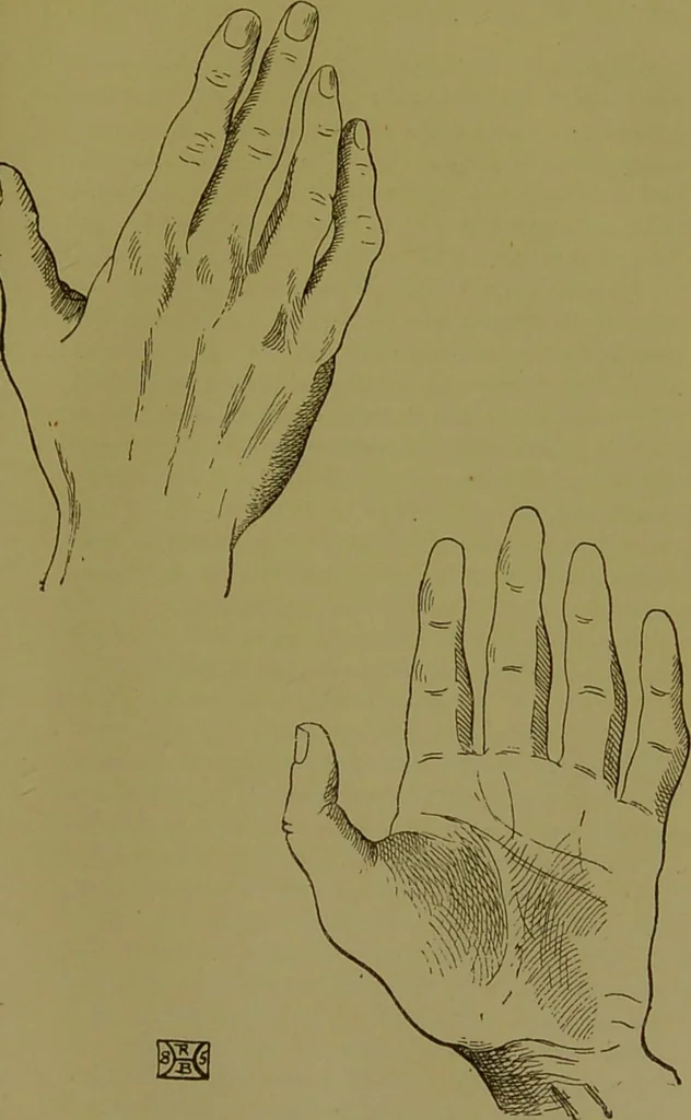 An illustration from A manual of cheirosophy : being a complete practical handbook of the twin sciences of cheirognomy and cheiromancy, by means whereof the past, the present, and the future may be read in the formations of the hands ; preceded by an introductory argument upon the science of cheirosophy and its claims to rank as a physical science / by Ed. Heron-Allen ... with full-page and other illustrations by Rosamund Brunel Horsley., 1892, leaf 169