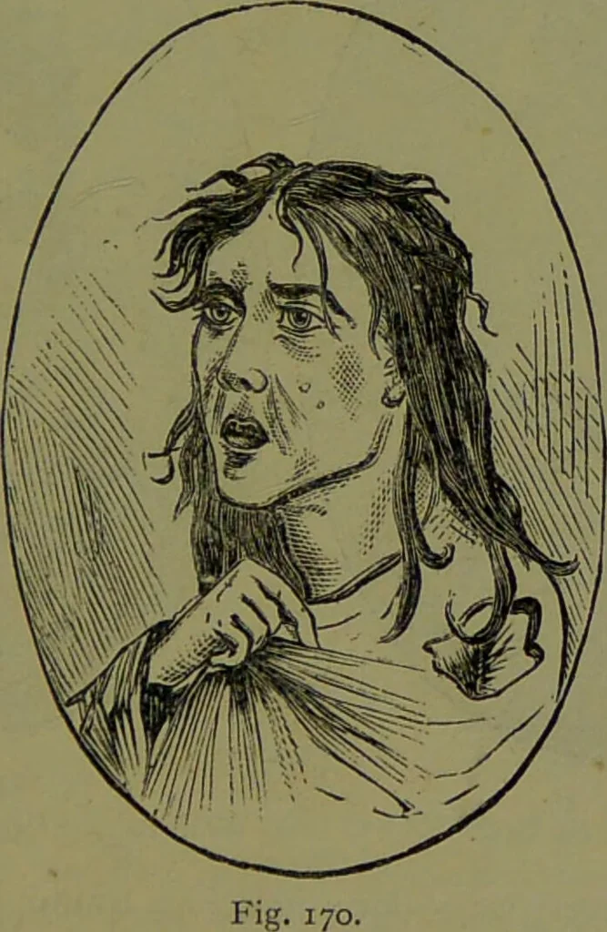 An illustration from Faces we meet, and, how to read them / by R.B.D. Wells., 1880, leaf 235