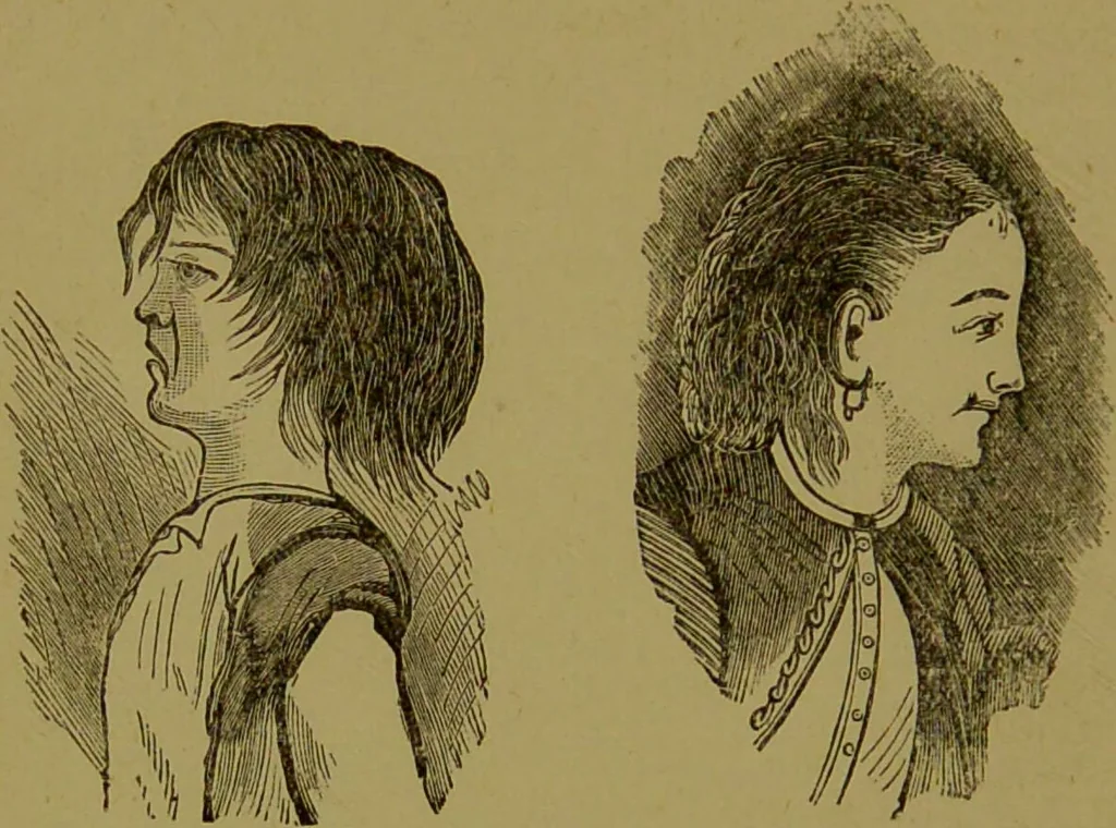 An illustration from Faces we meet, and, how to read them / by R.B.D. Wells., 1880, leaf 24