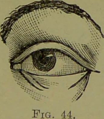 An illustration from Faces we meet, and, how to read them / by R.B.D. Wells., 1880, leaf 67