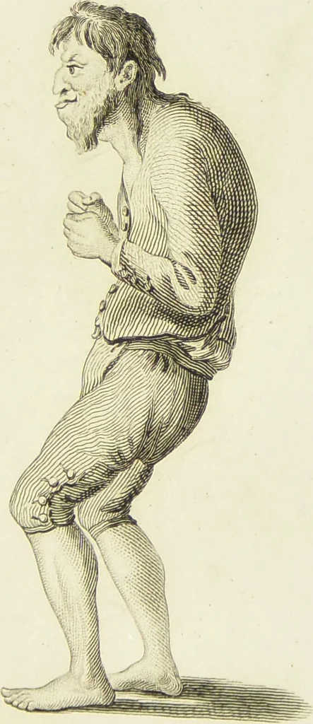 An illustration from Essays on physiognomy : designed to promote the knowledge and the love of mankind / written in the German language by John Caspar Lavater ; and translated into English by Thomas Holcroft ; to which are added one hundred physiognomonical rules, a posthumous work by Mr. Lavater and Memoirs of the life of the author., 1855, leaf 265