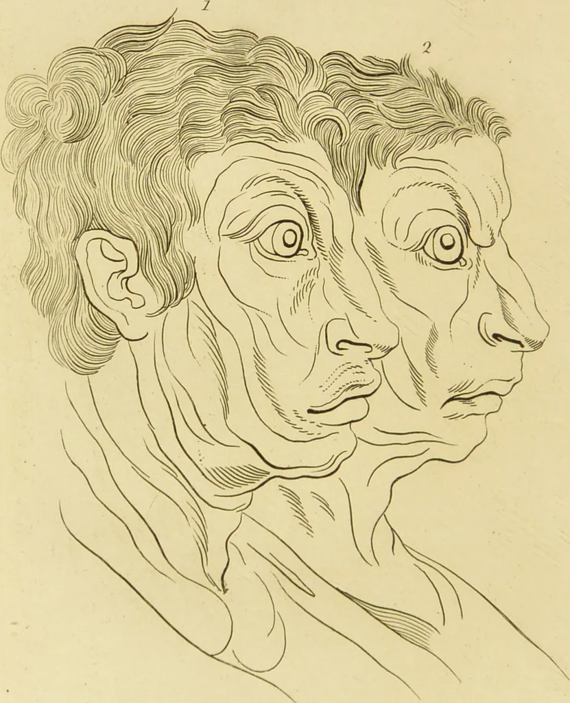 An illustration from Essays on physiognomy : designed to promote the knowledge and the love of mankind / written in the German language by John Caspar Lavater ; and translated into English by Thomas Holcroft ; to which are added one hundred physiognomonical rules, a posthumous work by Mr. Lavater and Memoirs of the life of the author., 1855, leaf 400