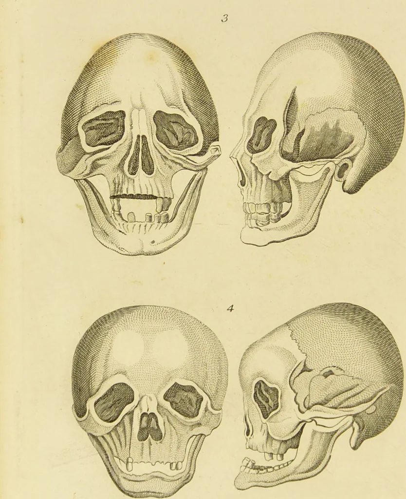 An illustration from Essays on physiognomy : designed to promote the knowledge and the love of mankind / written in the German language by John Caspar Lavater ; and translated into English by Thomas Holcroft ; to which are added one hundred physiognomonical rules, a posthumous work by Mr. Lavater and Memoirs of the life of the author., 1855, leaf 454