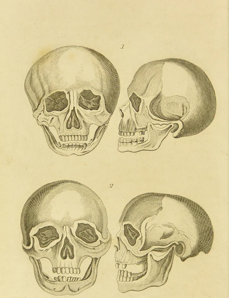 An illustration from Essays on physiognomy : designed to promote the knowledge and the love of mankind / written in the German language by John Caspar Lavater ; and translated into English by Thomas Holcroft ; to which are added one hundred physiognomonical rules, a posthumous work by Mr. Lavater and Memoirs of the life of the author., 1855, leaf 456