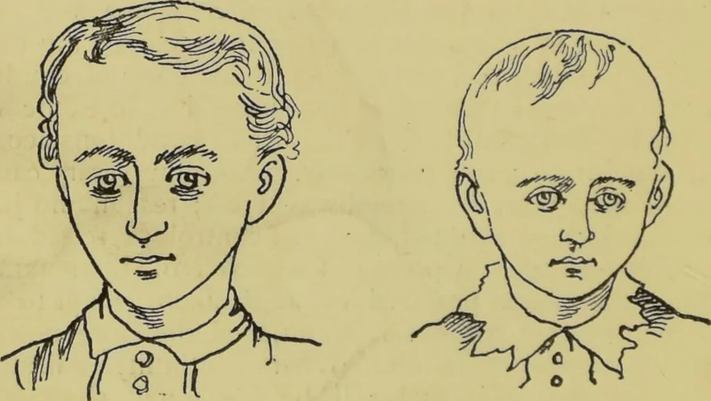An illustration from The modern self-instructor in phrenology, physiology & physiognomy, or, The people's hand-book of human nature : containing a view of the moral and theological bearing of the science of phrenology / by Gustavus Cohen., 1889, leaf 62