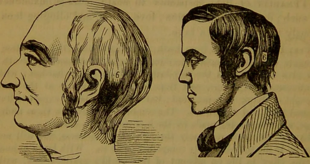 An illustration from Fowler's New illustrated self-instructor in phrenology and physiology : with over one hundred engravings, together with the chart and character of ... as marked by ... / by Lorenzo N. Fowler., 1891, leaf 100