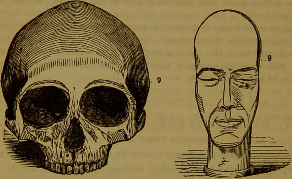 An illustration from Fowler's New illustrated self-instructor in phrenology and physiology : with over one hundred engravings, together with the chart and character of ... as marked by ... / by Lorenzo N. Fowler., 1891, leaf 108