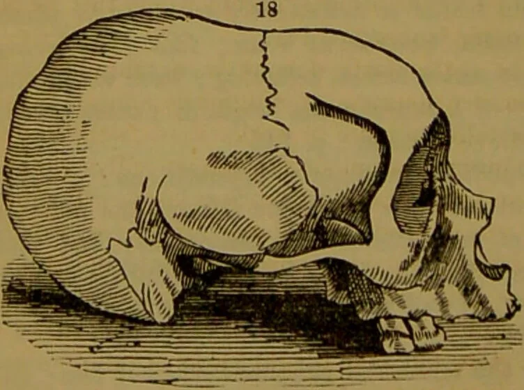 An illustration from Fowler's New illustrated self-instructor in phrenology and physiology : with over one hundred engravings, together with the chart and character of ... as marked by ... / by Lorenzo N. Fowler., 1891, leaf 132