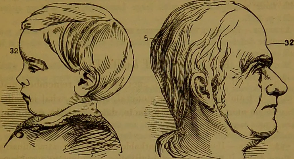 An illustration from Fowler's New illustrated self-instructor in phrenology and physiology : with over one hundred engravings, together with the chart and character of ... as marked by ... / by Lorenzo N. Fowler., 1891, leaf 161