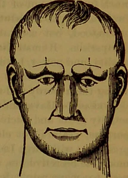 An illustration from Fowler's New illustrated self-instructor in phrenology and physiology : with over one hundred engravings, together with the chart and character of ... as marked by ... / by Lorenzo N. Fowler., 1891, leaf 165
