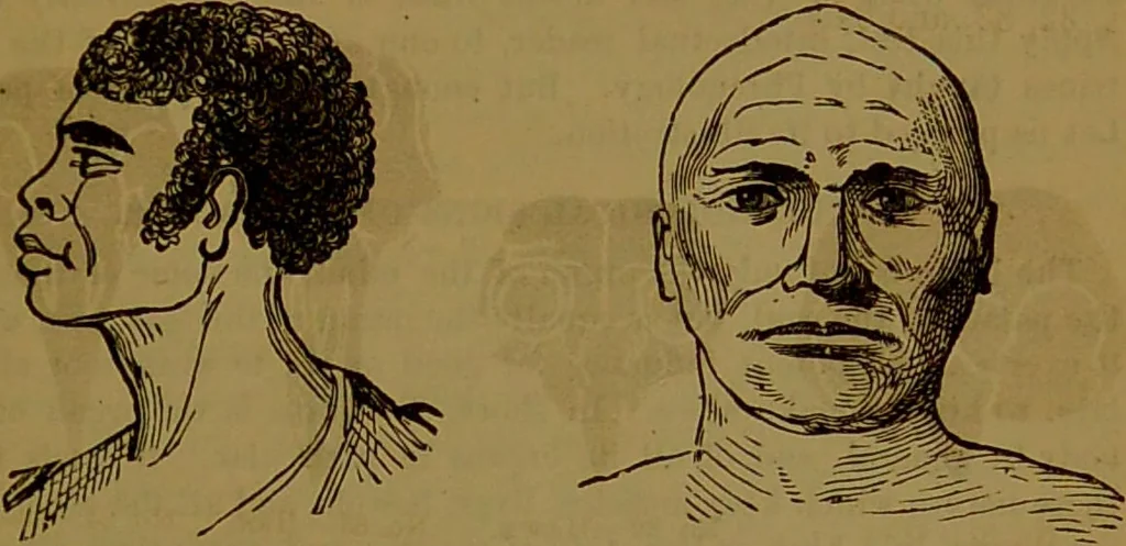 An illustration from Fowler's New illustrated self-instructor in phrenology and physiology : with over one hundred engravings, together with the chart and character of ... as marked by ... / by Lorenzo N. Fowler., 1891, leaf 73