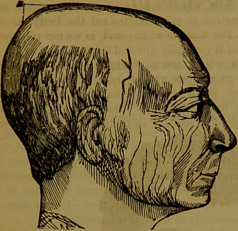 An illustration from Fowler's New illustrated self-instructor in phrenology and physiology : with over one hundred engravings, together with the chart and character of ... as marked by ... / by Lorenzo N. Fowler., 1891, leaf 77
