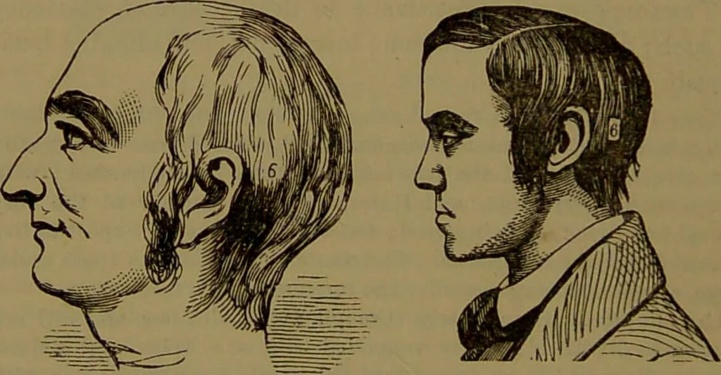An illustration from Fowler's New illustrated self-instructor in phrenology and physiology : with over one hundred engravings, together with the chart and character of ... as marked by ... / by Lorenzo N. Fowler., 1893, leaf 100