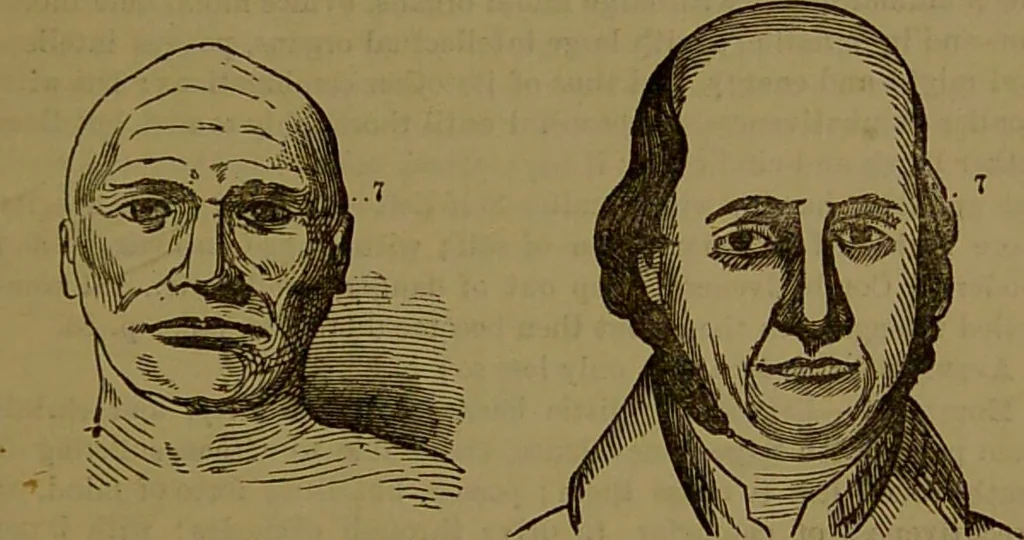 An illustration from Fowler's New illustrated self-instructor in phrenology and physiology : with over one hundred engravings, together with the chart and character of ... as marked by ... / by Lorenzo N. Fowler., 1893, leaf 103