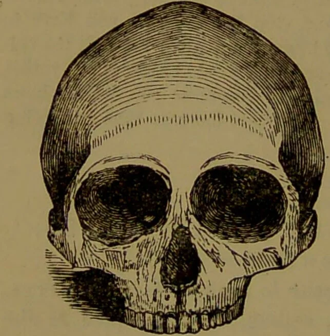 An illustration from Fowler's New illustrated self-instructor in phrenology and physiology : with over one hundred engravings, together with the chart and character of ... as marked by ... / by Lorenzo N. Fowler., 1893, leaf 108