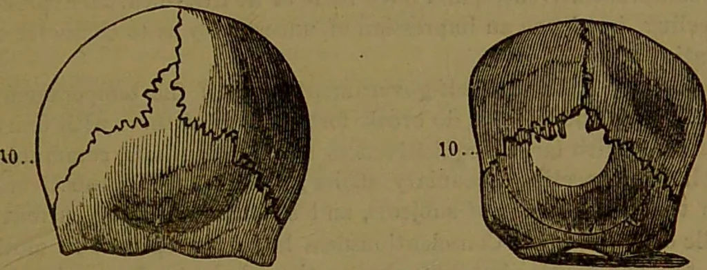 An illustration from Fowler's New illustrated self-instructor in phrenology and physiology : with over one hundred engravings, together with the chart and character of ... as marked by ... / by Lorenzo N. Fowler., 1893, leaf 111