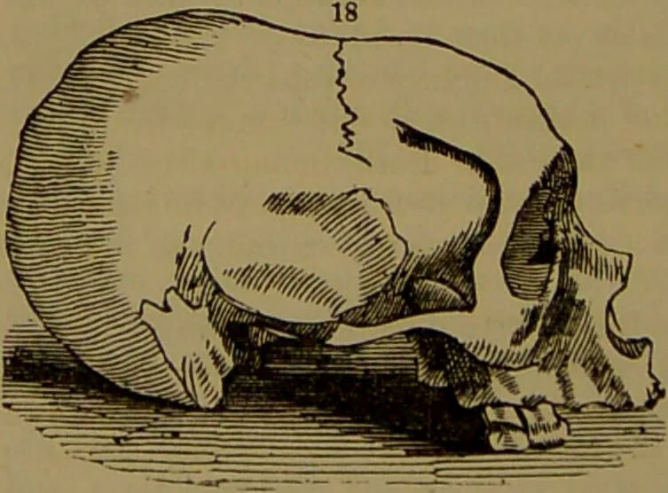 An illustration from Fowler's New illustrated self-instructor in phrenology and physiology : with over one hundred engravings, together with the chart and character of ... as marked by ... / by Lorenzo N. Fowler., 1893, leaf 132