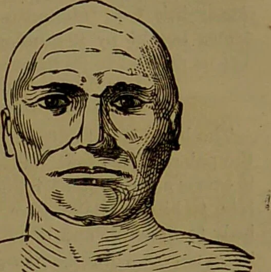 An illustration from Fowler's New illustrated self-instructor in phrenology and physiology : with over one hundred engravings, together with the chart and character of ... as marked by ... / by Lorenzo N. Fowler., 1893, leaf 73