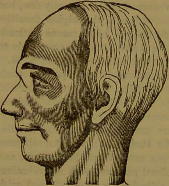 An illustration from Fowler's New illustrated self-instructor in phrenology and physiology : with over one hundred engravings, together with the chart and character of ... as marked by ... / by Lorenzo N. Fowler., 1893, leaf 94