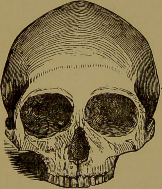 An illustration from Fowler's New illustrated self-instructor in phrenology and physiology : with over one hundred engravings, together with the chart and character of ... as marked by ... / by Lorenzo N. Fowler., 1895, leaf 108