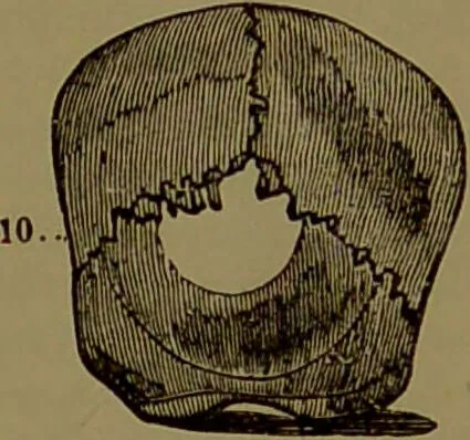An illustration from Fowler's New illustrated self-instructor in phrenology and physiology : with over one hundred engravings, together with the chart and character of ... as marked by ... / by Lorenzo N. Fowler., 1895, leaf 111