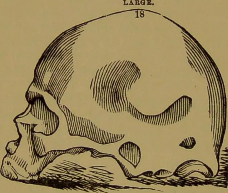 An illustration from Fowler's New illustrated self-instructor in phrenology and physiology : with over one hundred engravings, together with the chart and character of ... as marked by ... / by Lorenzo N. Fowler., 1895, leaf 132