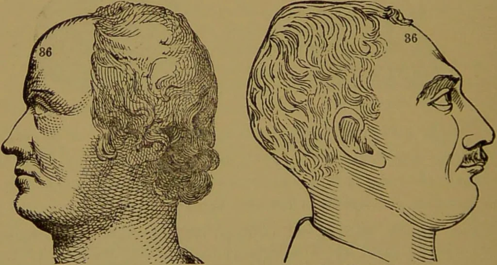 An illustration from Fowler's New illustrated self-instructor in phrenology and physiology : with over one hundred engravings, together with the chart and character of ... as marked by ... / by Lorenzo N. Fowler., 1895, leaf 168