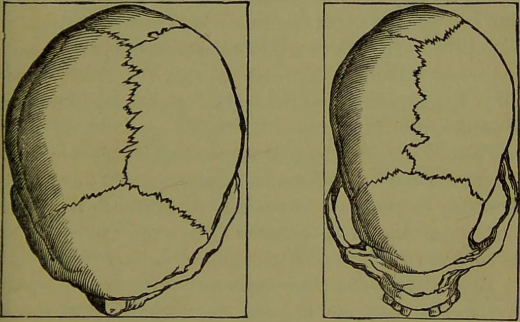 An illustration from A new illustrated hand-book of phrenology, physiology and physiognomy / by R.B.D. Wells., 1870, leaf 197
