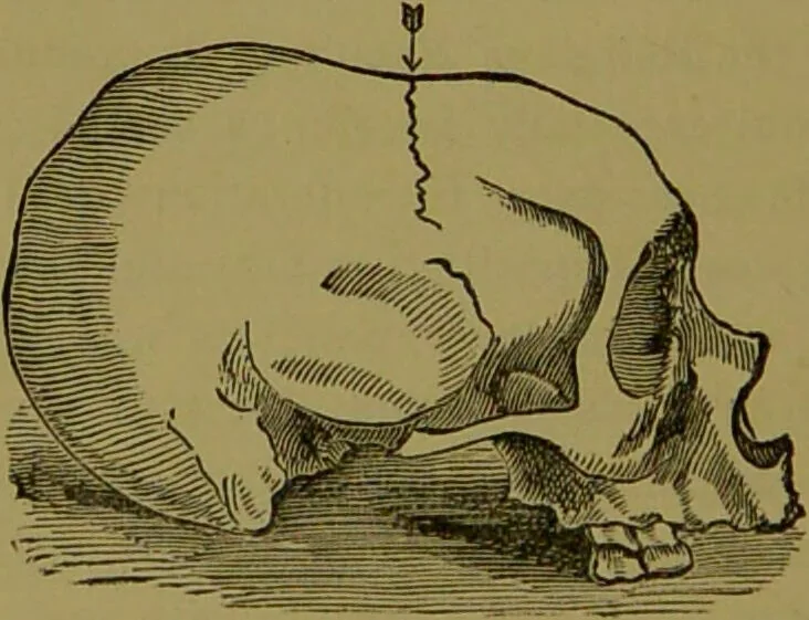 An illustration from A new illustrated hand-book of phrenology, physiology and physiognomy / by R.B.D. Wells., 1870, leaf 226