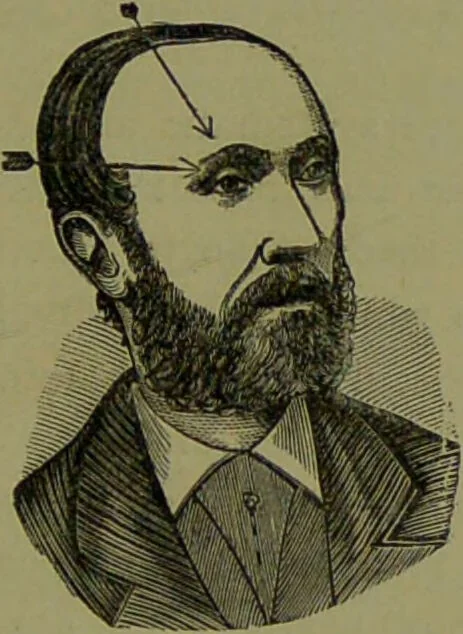 An illustration from A new illustrated hand-book of phrenology, physiology and physiognomy / by R.B.D. Wells., 1870, leaf 267