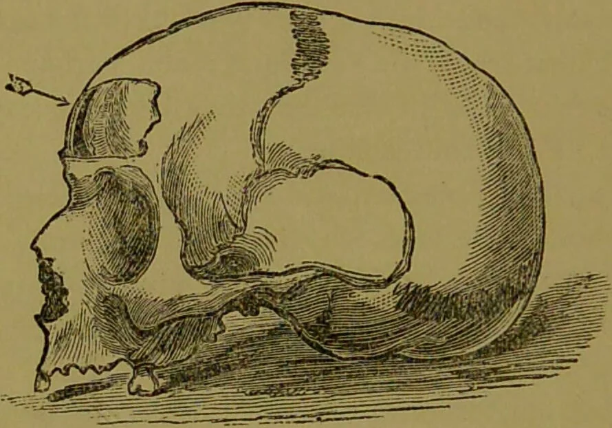 An illustration from A new illustrated hand-book of phrenology, physiology and physiognomy / by R.B.D. Wells., 1870, leaf 300