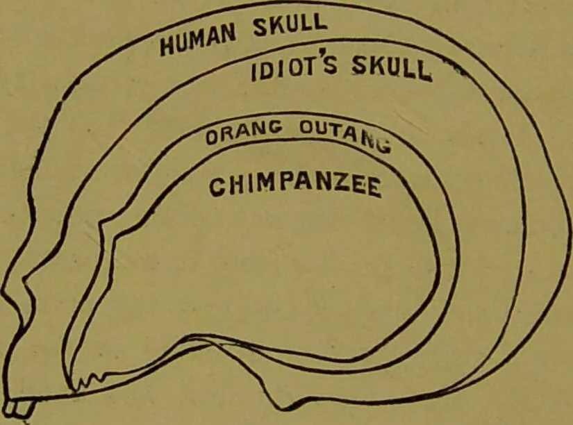 An illustration from A new illustrated hand-book of phrenology, physiology and physiognomy / by R.B.D. Wells., 1870, leaf 304