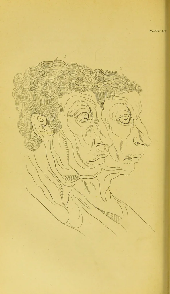 An illustration from Essays on physiognomy / translated from the German of John Caspar Lavater, by Thomas Holcroft. Also one hundred physiognomical rules, taken from a posthumous work of J. C. Lavater ; and a memoir of the author., 1880, leaf 398