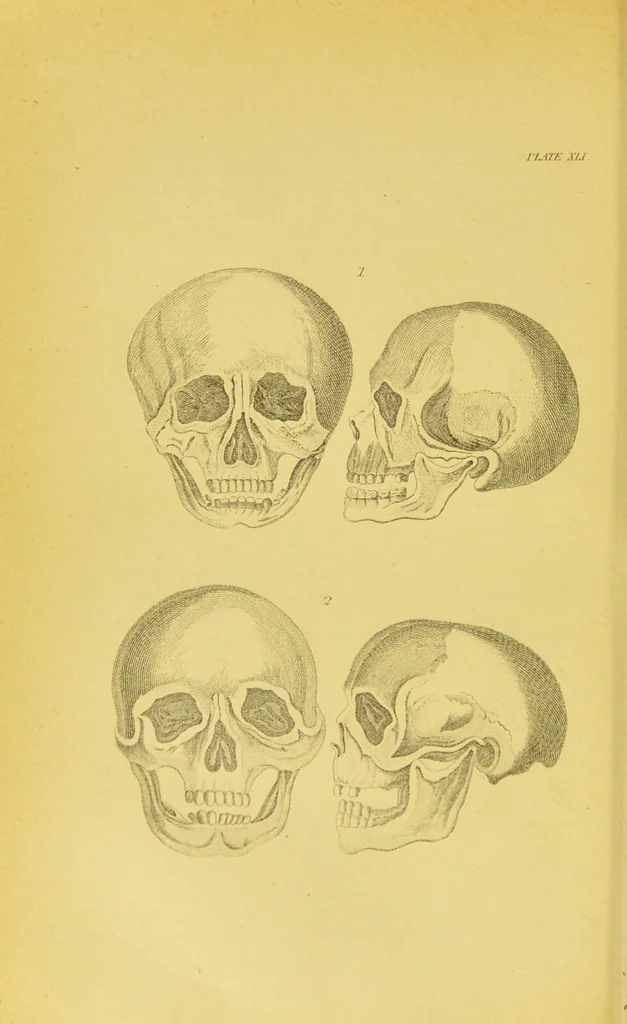 An illustration from Essays on physiognomy / translated from the German of John Caspar Lavater, by Thomas Holcroft. Also one hundred physiognomical rules, taken from a posthumous work of J. C. Lavater ; and a memoir of the author., 1880, leaf 454