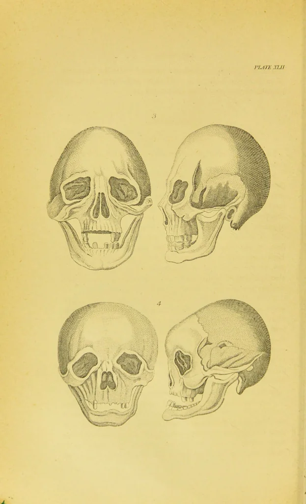 An illustration from Essays on physiognomy / translated from the German of John Caspar Lavater, by Thomas Holcroft. Also one hundred physiognomical rules, taken from a posthumous work of J. C. Lavater ; and a memoir of the author., 1880, leaf 456