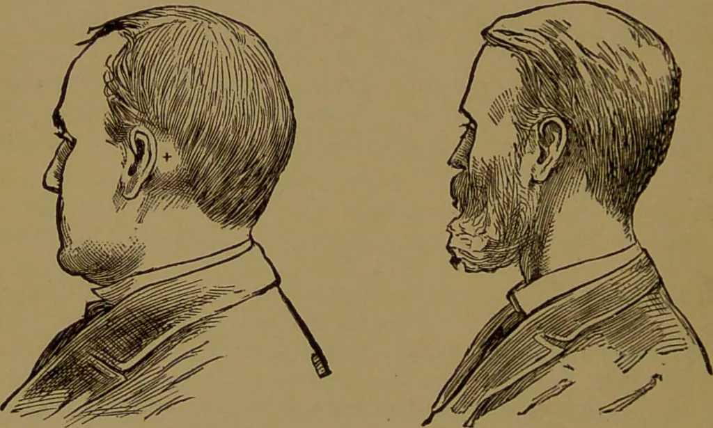 An illustration from The self-instructor in phrenology and physiology : with over one hundred new illustrations, including a chart for the use of practical phrenologists / by O.S. and L.N. Fowler. Rev. by Nelson Sizer., 1889, leaf 102
