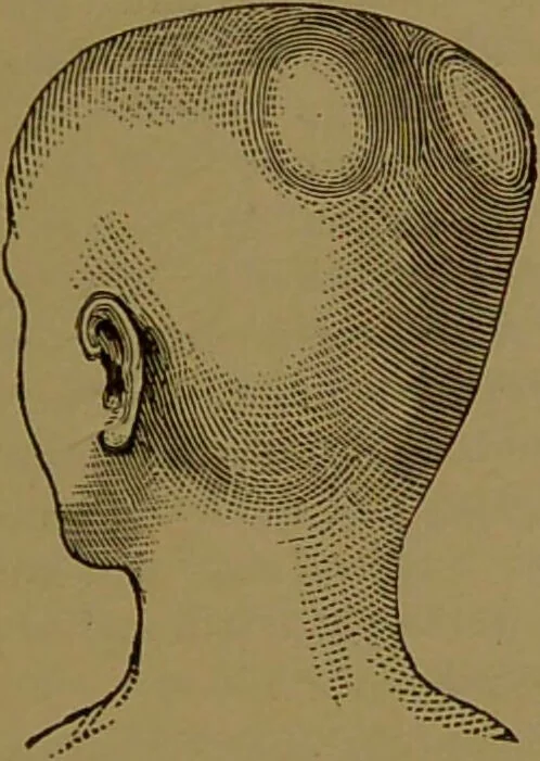 An illustration from The self-instructor in phrenology and physiology : with over one hundred new illustrations, including a chart for the use of practical phrenologists / by O.S. and L.N. Fowler. Rev. by Nelson Sizer., 1889, leaf 123