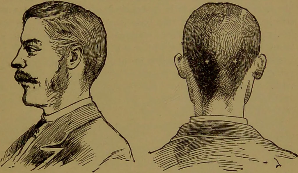 An illustration from The self-instructor in phrenology and physiology : with over one hundred new illustrations, including a chart for the use of practical phrenologists / by O.S. and L.N. Fowler. Rev. by Nelson Sizer., 1889, leaf 89