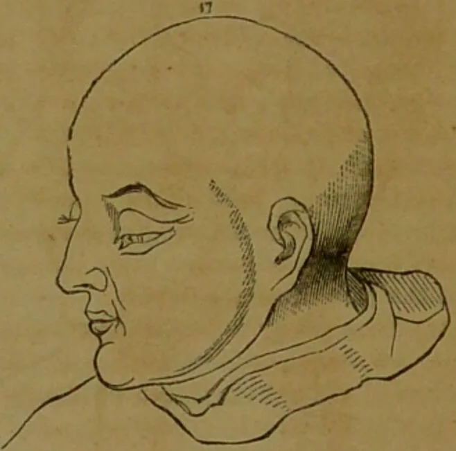 An illustration from Phrenology made practical and popularly explained / by Frederick Bridges., 1861, leaf 138