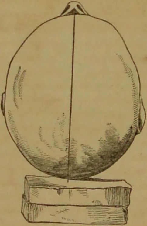 An illustration from Phrenology made practical and popularly explained / by Frederick Bridges., 1861, leaf 71