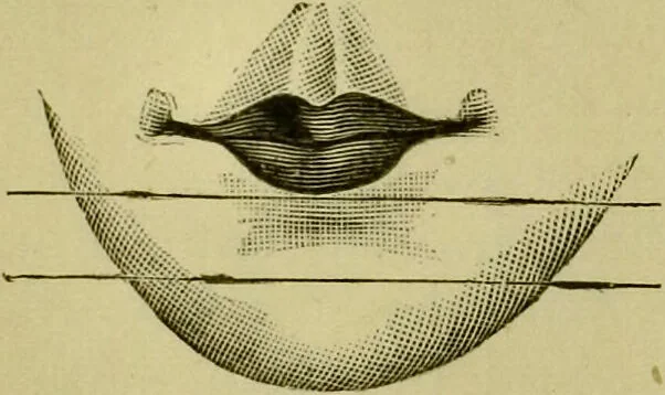 An illustration from A system of practical and scientific physiognomy, or, How to read faces : being a manual of instruction in the knowledge of the human physiognomy and organism, embracing the discoveries of located signs of character in the body and face, as shown by the five natural divisions of the countenance. Volume 2 / by Mary Olmstead Stanton., 1890, leaf 192