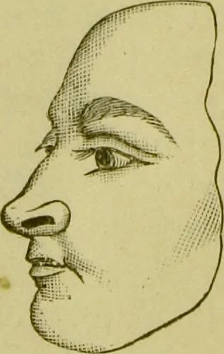 An illustration from A system of practical and scientific physiognomy, or, How to read faces : being a manual of instruction in the knowledge of the human physiognomy and organism, embracing the discoveries of located signs of character in the body and face, as shown by the five natural divisions of the countenance. Volume 2 / by Mary Olmstead Stanton., 1890, leaf 243