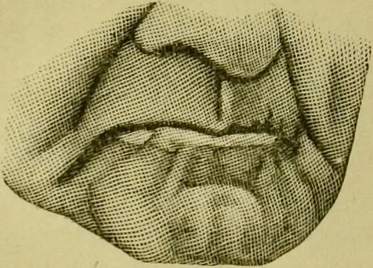 An illustration from A system of practical and scientific physiognomy, or, How to read faces : being a manual of instruction in the knowledge of the human physiognomy and organism, embracing the discoveries of located signs of character in the body and face, as shown by the five natural divisions of the countenance. Volume 2 / by Mary Olmstead Stanton., 1890, leaf 266