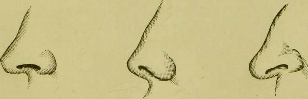 An illustration from A system of practical and scientific physiognomy, or, How to read faces : being a manual of instruction in the knowledge of the human physiognomy and organism, embracing the discoveries of located signs of character in the body and face, as shown by the five natural divisions of the countenance. Volume 2 / by Mary Olmstead Stanton., 1890, leaf 313
