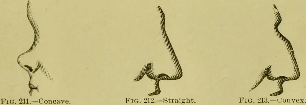 An illustration from A system of practical and scientific physiognomy, or, How to read faces : being a manual of instruction in the knowledge of the human physiognomy and organism, embracing the discoveries of located signs of character in the body and face, as shown by the five natural divisions of the countenance. Volume 2 / by Mary Olmstead Stanton., 1890, leaf 313