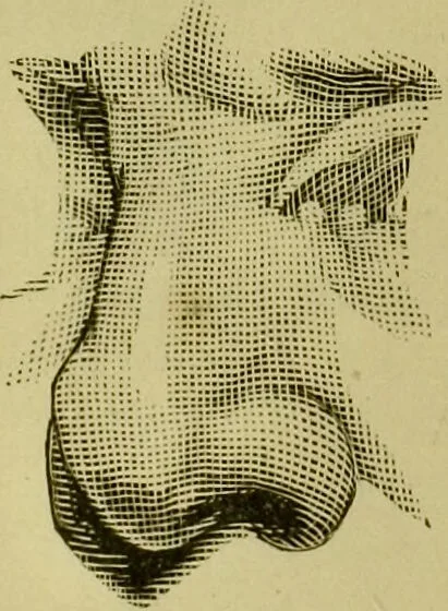 An illustration from A system of practical and scientific physiognomy, or, How to read faces : being a manual of instruction in the knowledge of the human physiognomy and organism, embracing the discoveries of located signs of character in the body and face, as shown by the five natural divisions of the countenance. Volume 2 / by Mary Olmstead Stanton., 1890, leaf 334