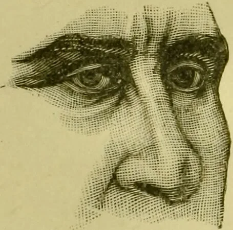 An illustration from A system of practical and scientific physiognomy, or, How to read faces : being a manual of instruction in the knowledge of the human physiognomy and organism, embracing the discoveries of located signs of character in the body and face, as shown by the five natural divisions of the countenance. Volume 2 / by Mary Olmstead Stanton., 1890, leaf 335