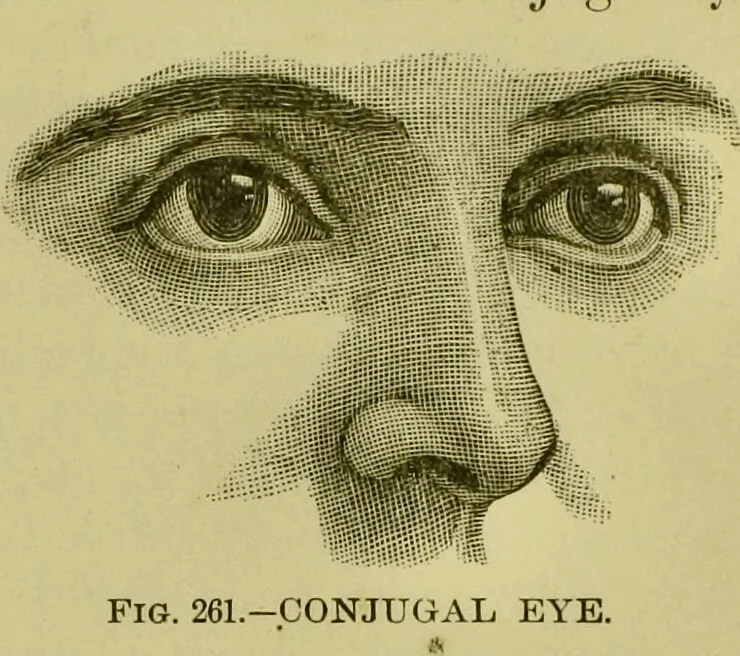 An illustration from A system of practical and scientific physiognomy, or, How to read faces : being a manual of instruction in the knowledge of the human physiognomy and organism, embracing the discoveries of located signs of character in the body and face, as shown by the five natural divisions of the countenance. Volume 2 / by Mary Olmstead Stanton., 1890, leaf 377